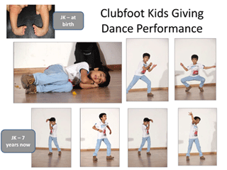 ORTHOPEDIC CHILD DOCTOR IN C G ROAD , child orthopedic doctor in udaipur