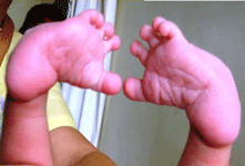 child orthopedic specialist doctor in satellite, CHILD ORTHOPEDIC DOCTOR AMBALI
