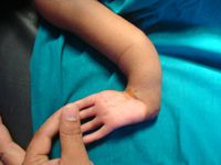 pediatric orthopedic doctor in satellite, PEDIATRIC ORTHOPEDIC DOCTOR IN DRIVEN ROAD