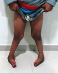pediatric orthopedic doctor in satellite, BEST PEDIATRIC ORTHOPEDIC DOCTOR