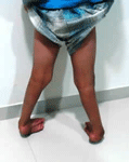 ORTHOPEDIC CHILD DOCTOR IN C G ROAD, child orthopedic doctor in mehsana